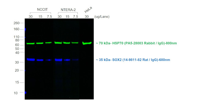 Rat IgG (H+L) Cross-Adsorbed Secondary Antibody in Western Blot (WB)