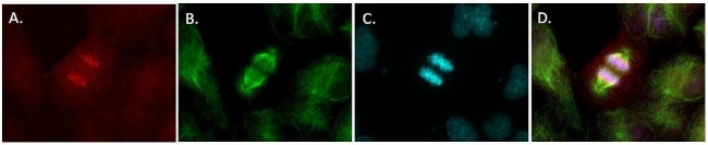 Mouse IgG1 Cross-Adsorbed Secondary Antibody in Immunocytochemistry (ICC/IF)