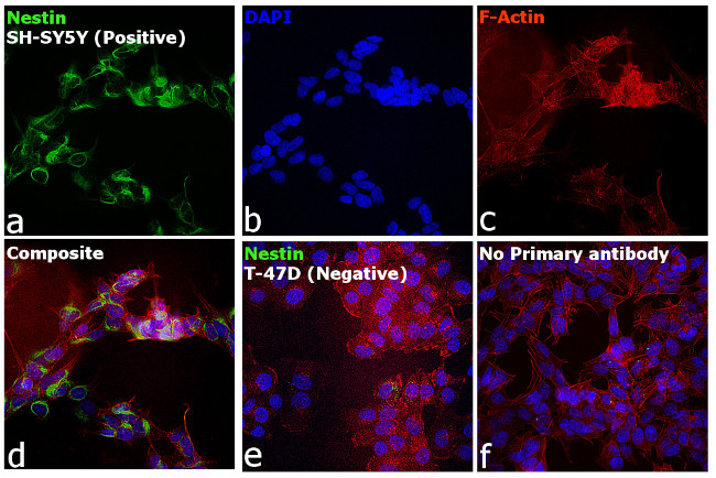 Mouse IgG1 Cross-Adsorbed Secondary Antibody in Immunocytochemistry (ICC/IF)