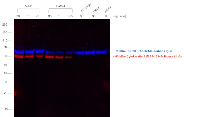 Mouse IgG1 Cross-Adsorbed Secondary Antibody in Western Blot (WB)