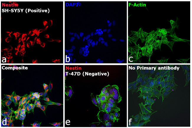 Mouse IgG1 Cross-Adsorbed Secondary Antibody in Immunocytochemistry (ICC/IF)