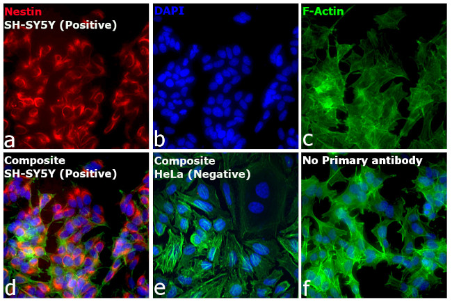 Mouse IgG1 Cross-Adsorbed Secondary Antibody in Immunocytochemistry (ICC/IF)