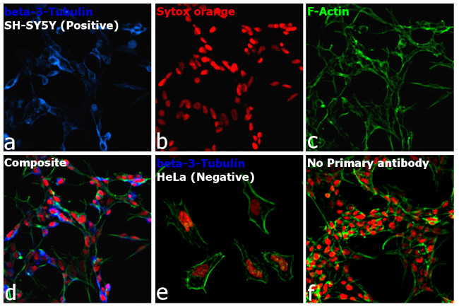 Mouse IgG2a Cross-Adsorbed Secondary Antibody in Immunocytochemistry (ICC/IF)