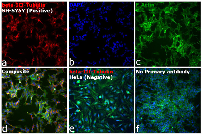 Mouse IgG2a Cross-Adsorbed Secondary Antibody in Immunocytochemistry (ICC/IF)