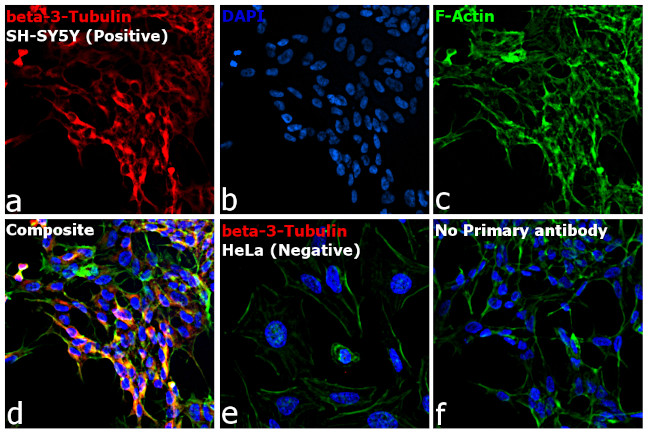 Mouse IgG2a Cross-Adsorbed Secondary Antibody in Immunocytochemistry (ICC/IF)