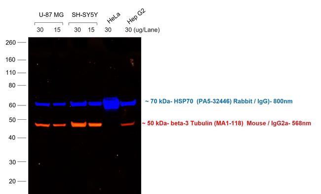 Mouse IgG2a Cross-Adsorbed Secondary Antibody in Western Blot (WB)