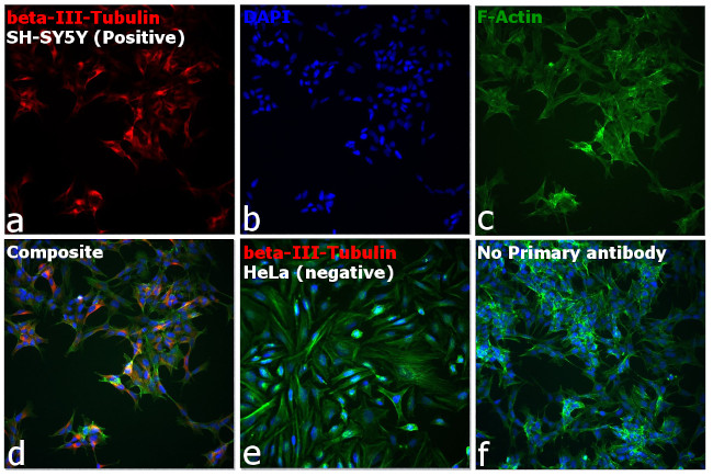 Mouse IgG2a Cross-Adsorbed Secondary Antibody in Immunocytochemistry (ICC/IF)