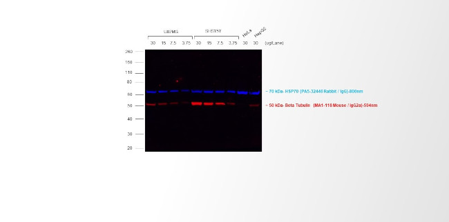 Mouse IgG2a Cross-Adsorbed Secondary Antibody in Western Blot (WB)