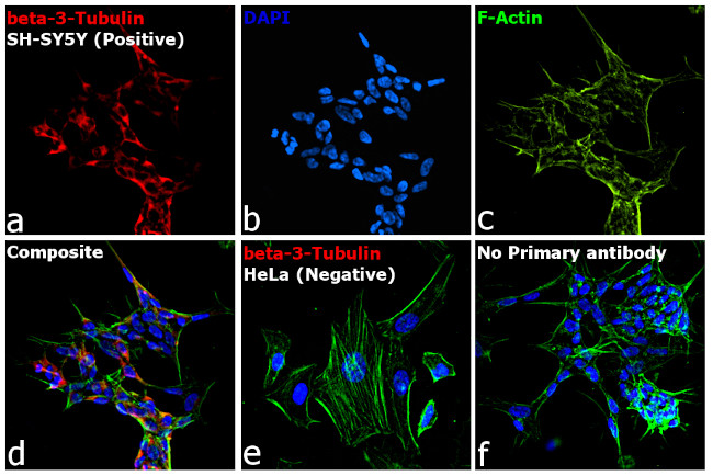 Mouse IgG2a Cross-Adsorbed Secondary Antibody in Immunocytochemistry (ICC/IF)