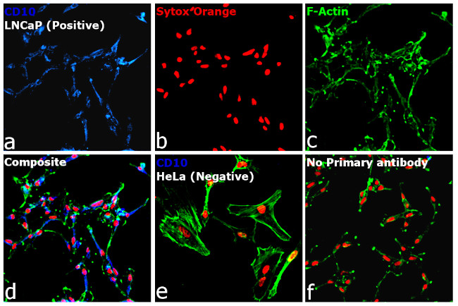 Mouse IgG2b Cross-Adsorbed Secondary Antibody in Immunocytochemistry (ICC/IF)