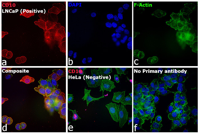 Mouse IgG2b Cross-Adsorbed Secondary Antibody in Immunocytochemistry (ICC/IF)