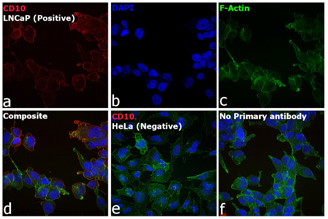 Mouse IgG2b Cross-Adsorbed Secondary Antibody in Immunocytochemistry (ICC/IF)