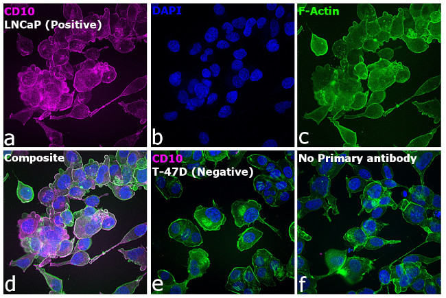 Mouse IgG2b Secondary Antibody in Immunocytochemistry (ICC/IF)