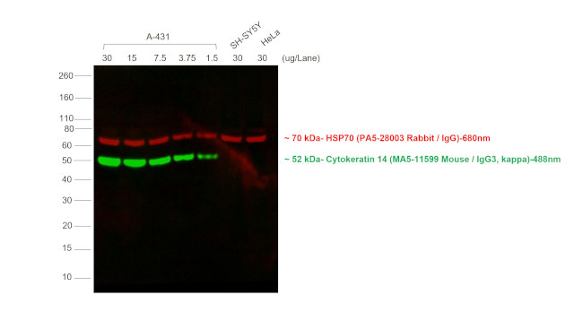 Mouse IgG3 Cross-Adsorbed Secondary Antibody in Western Blot (WB)