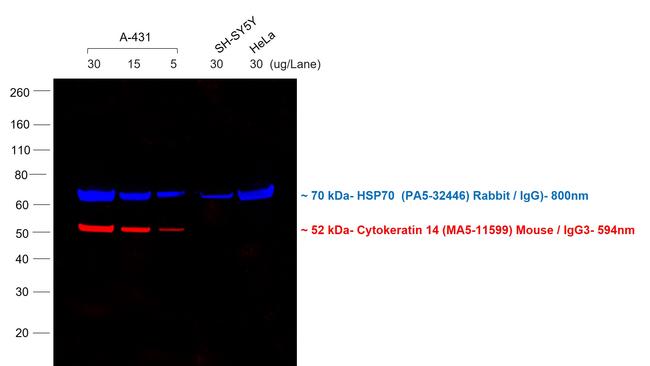 Mouse IgG3 Cross-Adsorbed Secondary Antibody in Western Blot (WB)