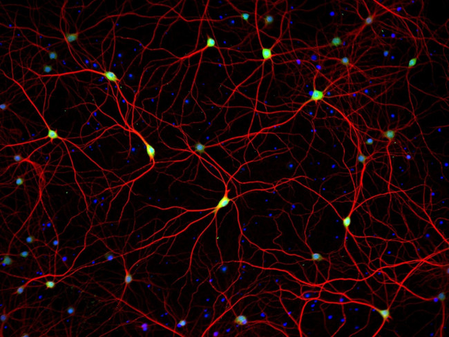 Mouse IgG (H+L) Highly Cross-Adsorbed Secondary Antibody in Immunocytochemistry (ICC/IF)