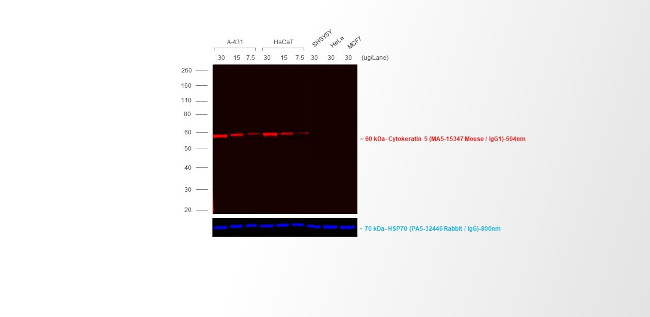 Mouse IgG (H+L) Cross-Adsorbed Secondary Antibody in Western Blot (WB)