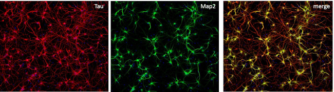 Rabbit IgG (H+L) Highly Cross-Adsorbed Secondary Antibody in Immunocytochemistry (ICC/IF)