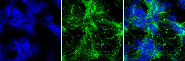 Rabbit IgG (H+L) Highly Cross-Adsorbed Secondary Antibody in Immunocytochemistry (ICC/IF)