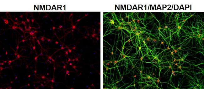 Rabbit IgG (H+L) Highly Cross-Adsorbed Secondary Antibody in Immunocytochemistry (ICC/IF)