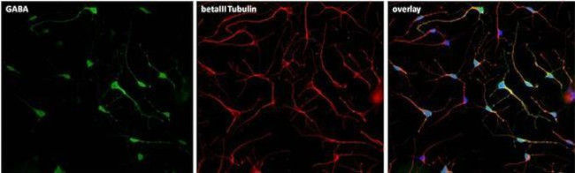 Rabbit IgG (H+L) Highly Cross-Adsorbed Secondary Antibody in Immunocytochemistry (ICC/IF)