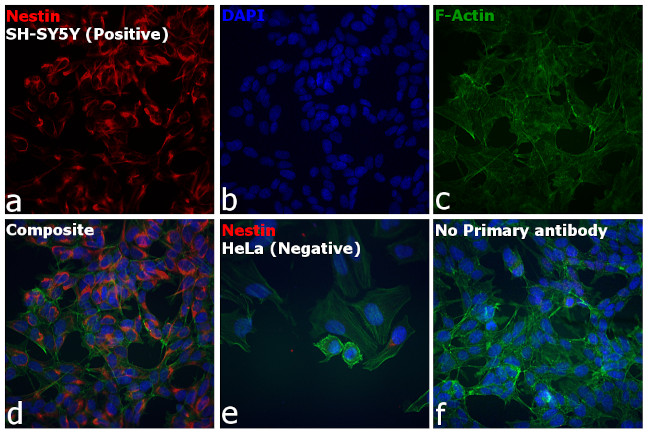 Mouse IgG (H+L) Cross-Adsorbed Secondary Antibody in Immunocytochemistry (ICC/IF)