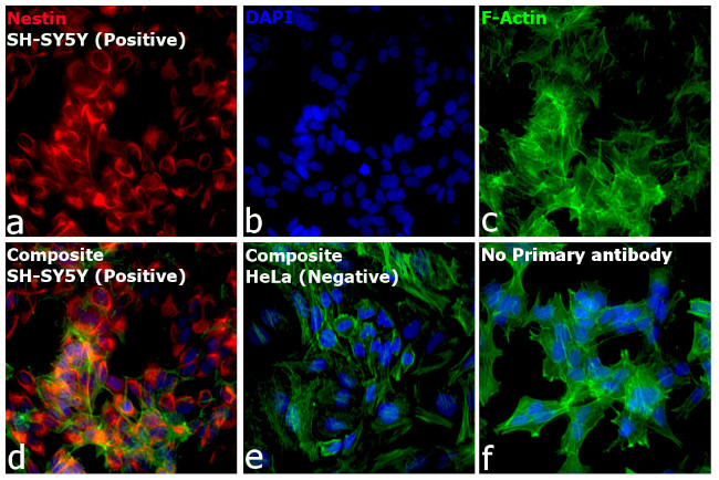 Mouse IgG (H+L) Cross-Adsorbed Secondary Antibody in Immunocytochemistry (ICC/IF)