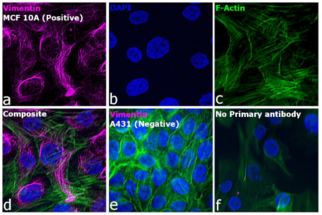 Mouse IgM (Heavy chain) Secondary Antibody in Immunocytochemistry (ICC/IF)