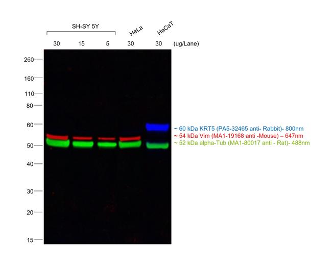 Mouse IgM (Heavy chain) Secondary Antibody in Western Blot (WB)