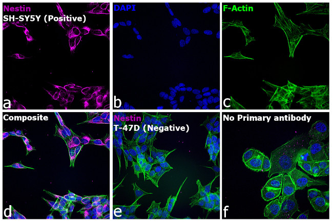 Mouse IgG (H+L) Cross-Adsorbed Secondary Antibody in Immunocytochemistry (ICC/IF)