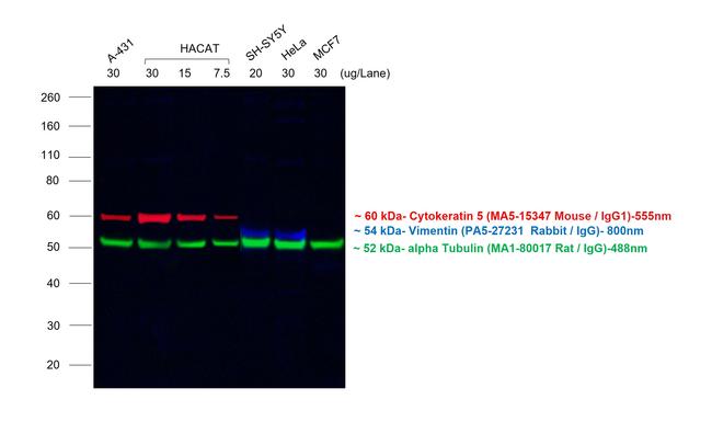 Mouse IgG1 Cross-Adsorbed Secondary Antibody in Western Blot (WB)