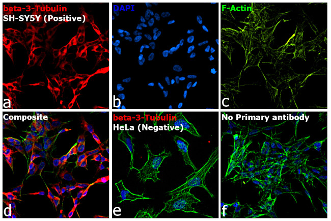 Mouse IgG2a Cross-Adsorbed Secondary Antibody in Immunocytochemistry (ICC/IF)