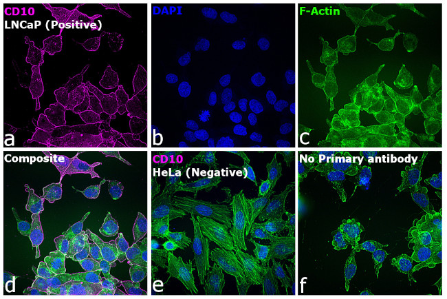 Mouse IgG2b Cross-Adsorbed Secondary Antibody in Immunocytochemistry (ICC/IF)