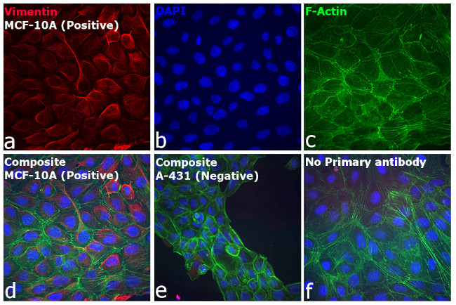 Rabbit IgG (H+L) Cross-Adsorbed Secondary Antibody in Immunocytochemistry (ICC/IF)