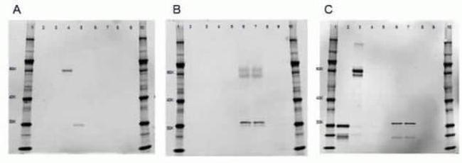 Rat IgG (H+L) Cross-Adsorbed Secondary Antibody in Western Blot (WB)