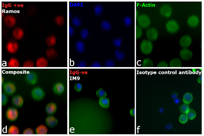 Human IgM (Heavy chain) Cross-Adsorbed Secondary Antibody in Immunocytochemistry (ICC/IF)