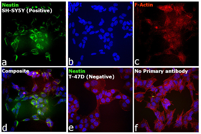 Mouse IgG (H+L) Cross-Adsorbed Secondary Antibody in Immunocytochemistry (ICC/IF)