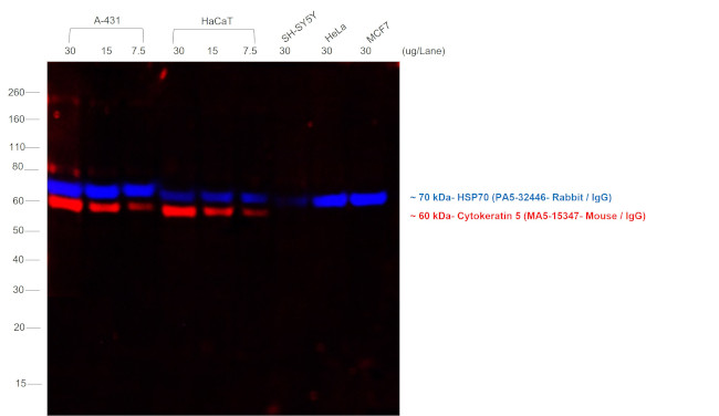 Mouse IgG (H+L) Cross-Adsorbed Secondary Antibody in Western Blot (WB)