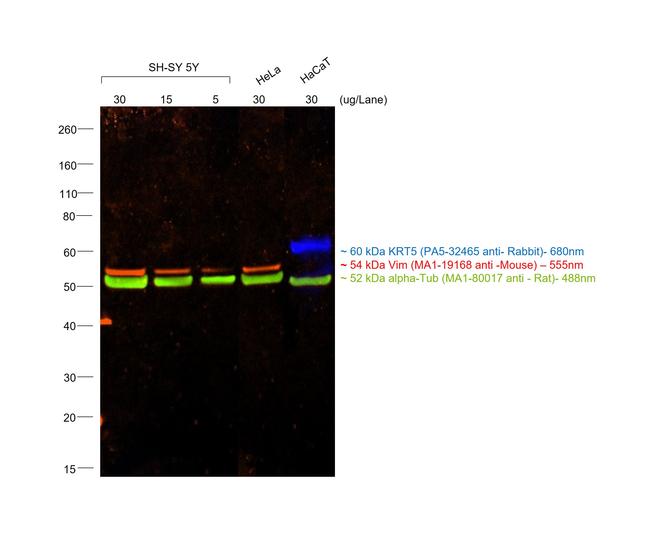 Mouse IgM (Heavy chain) Cross-Adsorbed Secondary Antibody in Western Blot (WB)