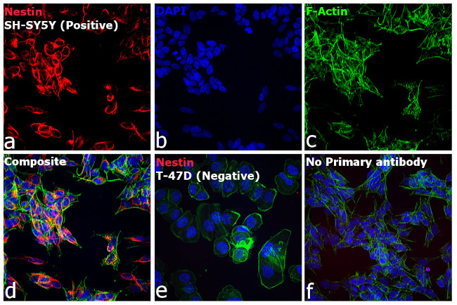 Mouse IgG (H+L) Cross-Adsorbed Secondary Antibody in Immunocytochemistry (ICC/IF)