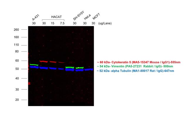 Mouse IgG (H+L) Cross-Adsorbed Secondary Antibody in Western Blot (WB)