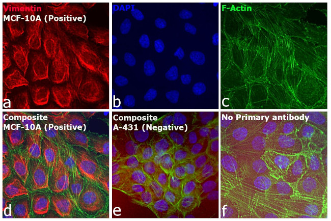 Rabbit IgG (H+L) Cross-Adsorbed Secondary Antibody in Immunocytochemistry (ICC/IF)