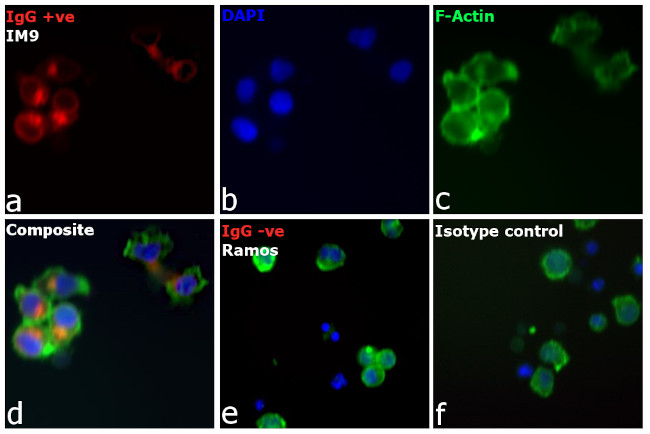 Human IgG (H+L) Cross-Adsorbed Secondary Antibody in Immunocytochemistry (ICC/IF)