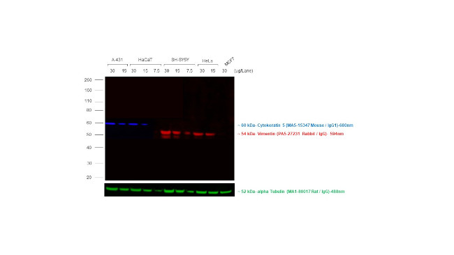 Rabbit IgG (H+L) Cross-Adsorbed Secondary Antibody in Western Blot (WB)