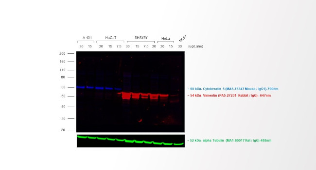 Rabbit IgG (H+L) Cross-Adsorbed Secondary Antibody in Western Blot (WB)