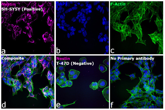 Mouse IgG (H+L) Cross-Adsorbed Secondary Antibody in Immunocytochemistry (ICC/IF)