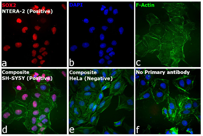 Rat IgG (H+L) Cross-Adsorbed Secondary Antibody in Immunocytochemistry (ICC/IF)