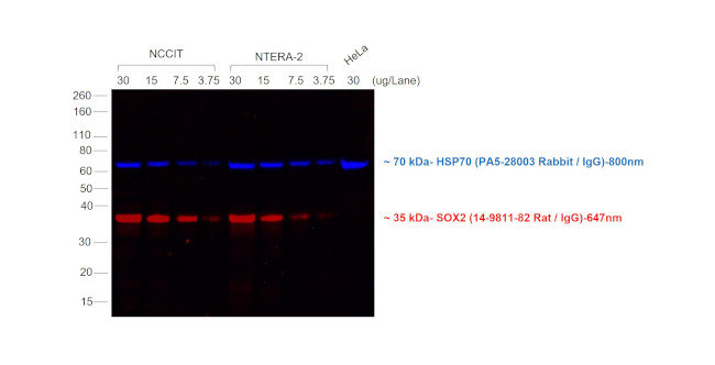 Rat IgG (H+L) Cross-Adsorbed Secondary Antibody in Western Blot (WB)