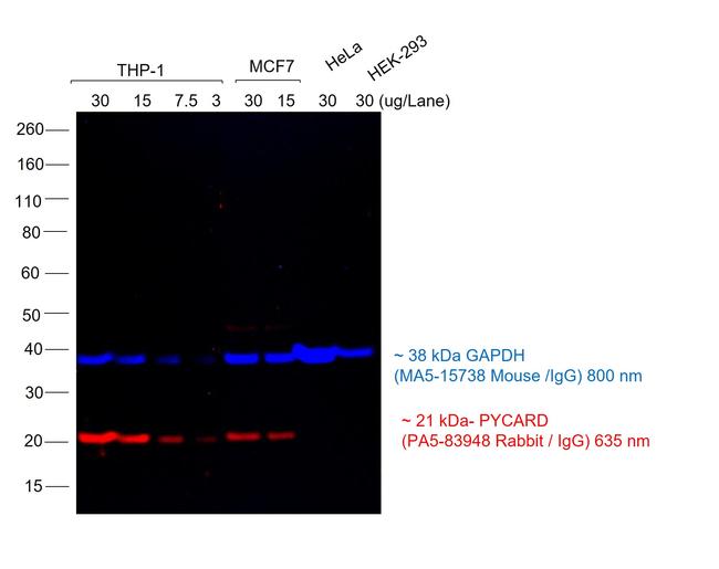 Rabbit IgG (H+L) Cross-Adsorbed Secondary Antibody in Western Blot (WB)