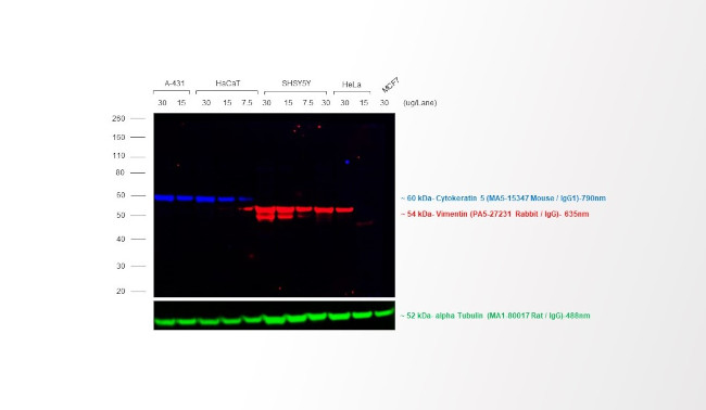 Rabbit IgG (H+L) Highly Cross-Adsorbed Secondary Antibody in Western Blot (WB)